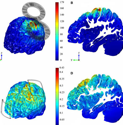 tACS Archives - Neuroelectrics Neuroelectrics Blog - Latest news about EEG  & Brain Stimulation Neuroscince