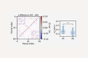 Brain Dynamics in Alzheimer’s Disease: Insights from Computational Spin-Glass Models